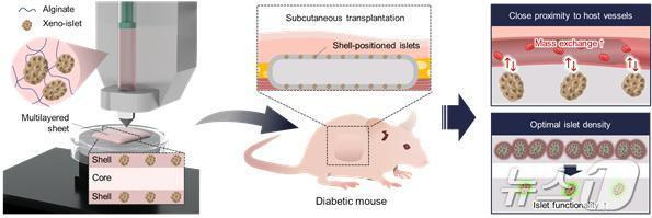 피하 췌도 이식의 개념도. (UNIST 제공)