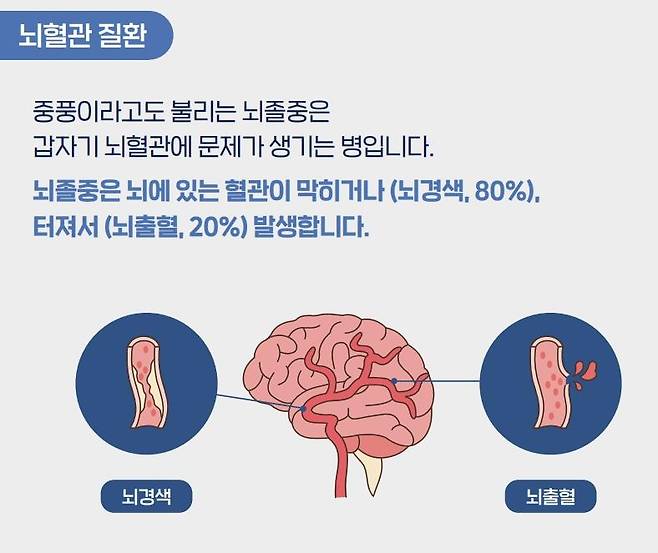 [대한뇌졸중학회 제공]