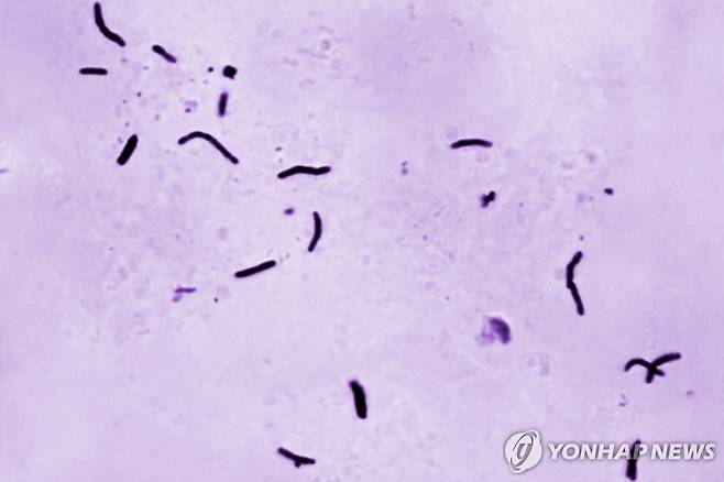 결핵균 [AP 연합뉴스 자료사진. 재판매 및 DB 금지]