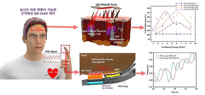 탈모 치료용 QD-OLED 패치 [한국연구재단 제공. 재판매 및 DB 금지]