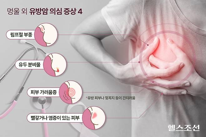 유방 피부나 젖꼭지 등 가슴 쪽 피부가 간지럽다면 유방암을 의심해 볼 수 있다/그래픽=김민선​