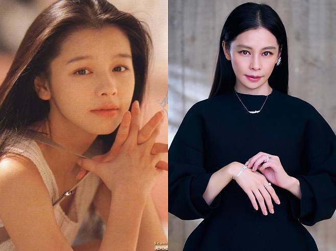 대만 미녀 가수 겸 배우 비비안 수(49)가 갑상선암 수술을 받고 재활 중인 근황을 알렸다./사진=온라인 커뮤니티, 비비안 수 SNS