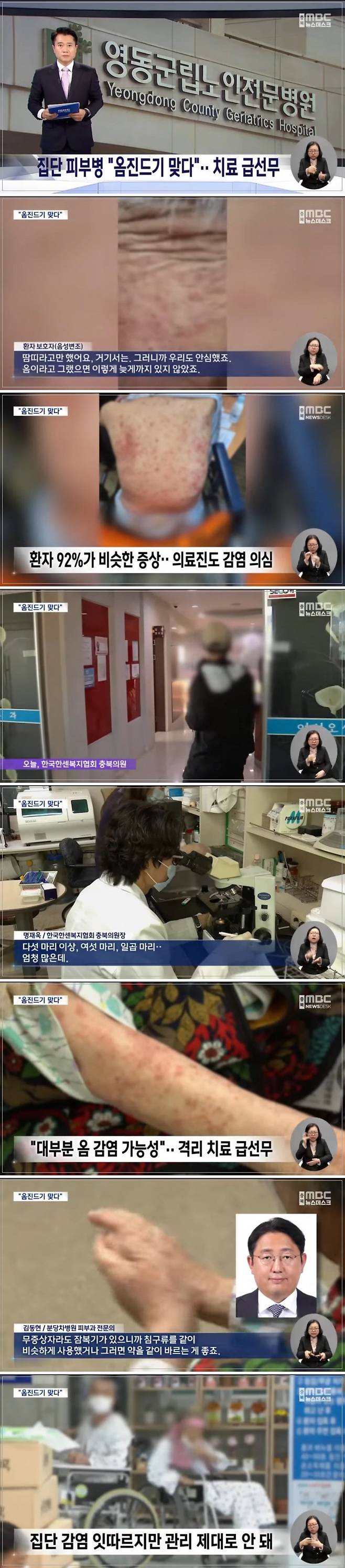 e_sa35bbe002_98ff135407c13315baf381f984107d959c937ae5.jpg 집단 피부병 감염 터진 요양원