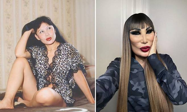 성형수술 부작용으로 얼굴이 변한 멕시코인 린 메이의 과거(왼쪽)과 현재(오른쪽)./사진=린 메이 인스타그램 캡처