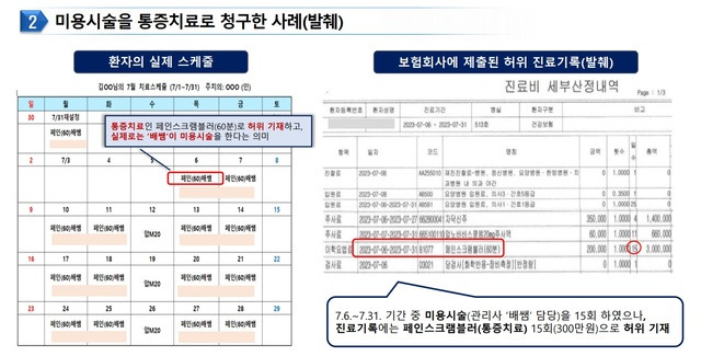 미용시술을 통증치료로 청구한 사례. 금융감독원