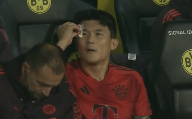 ▲ 김민재는 독일 도르트문트의 지그날 이두나 파크에서 열린 2024-25시즌 분데스리가 12라운드 도르트문트전에서 후반 80분까지 뮌헨의 수비를 책임지며 인상적인 활약을 펼쳤다. 뮌헨은 이 경기에서 1-1 무승부를 기록하며 리그 무패 행진을 이어갔다. 후반 80분 상대 선수와 볼 다툼 도중 팔꿈치에 얼굴을 맞아 눈썹 부위 출혈이 발생했다. 출혈로 인해 교체됐다. 경기 후 기자회견에서 김민재 컨디션에 대한 질문이 있었는데 “김민재는 눈썹 부위가 찢어져 몇 바늘 봉합했다. 하지만 김민재는 괴물 같은 선수다. 이런 부상은 그를 흔들지 못한다. 곧바로 출전 준비가 될 것”이라는 발표가 있었다