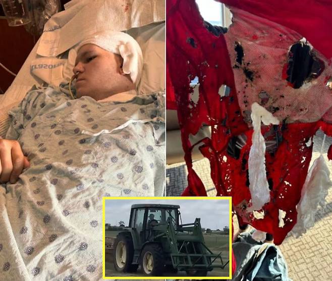 땅콩 수확 중 감전 사고를 당해 왼팔을 잃은 10대 미국 소년 사연이 전해졌다. 사고 당시 트랙터에 연결된 농기구에 고압 전선이 닿으면서 불이 붙었다. 소년은 트랙터와 기구를 분리하기 위해 시도했으나 이 과정에서 감전됐다. 소년은 신체의 60% 정도가 탔으며 3도 화상을 입은 상태였다. 왼쪽 팔은 부상이 심해 절단해야만 했다. [사진=KWTX]