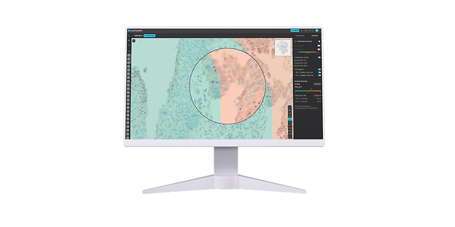 루닛 AI 기반 면역조직염색 분석 솔루션 '루닛 스코프 uIHC'./루닛