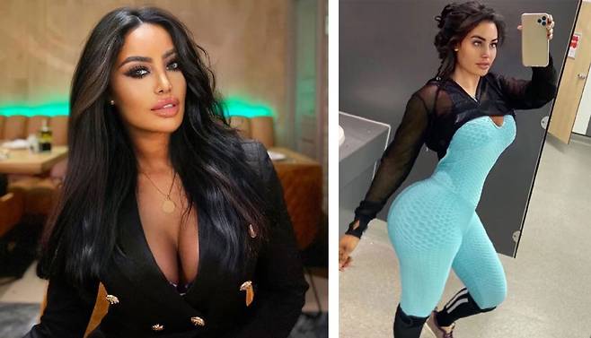 영국의 한 40대 모델이 BBL 수술을 받은 후 사망한 사연이 공개됐다./사진=더 선‧데일리메일