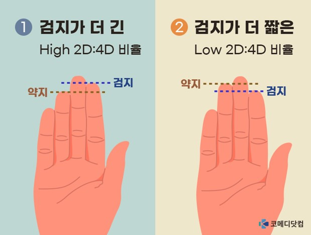 2D=검지, 4D=약지 ⓛ High 2D:4D 비율은 검지가 약지보다 긴 모습이고 ② Low 2D:4D 비율은 검지가 약지보다 짧은 모습. Low 2D:4D 비율이 높을수록 대머리 가능성도 높다. [이미지=코메디닷컴DB]