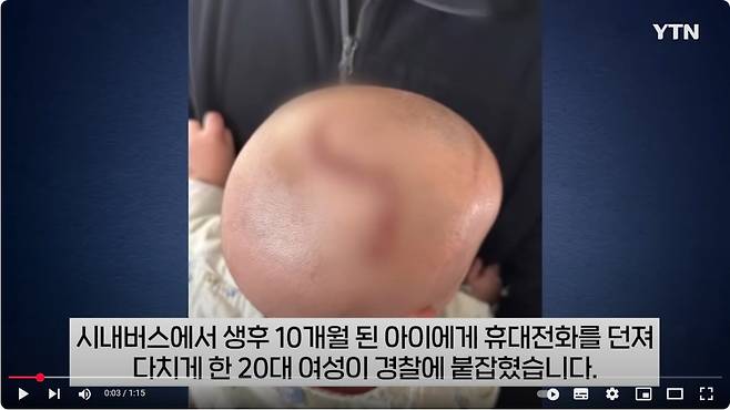 10개월 1.JPG 시내버스에서 생후 10개월된 아기에게 핸드폰 던져 중상 입힌 20대 여성