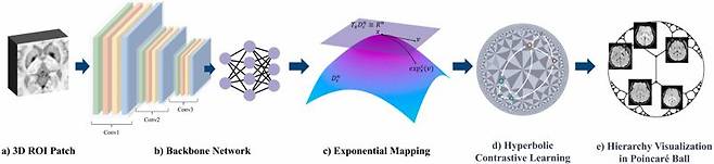 비정형 파킨슨 증후군 진단 시스템 이미지. 부산대 제공