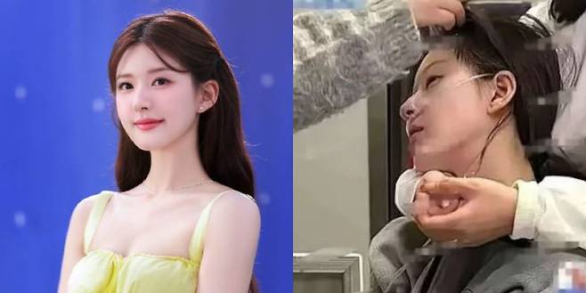 사진설명=중국의 인기 여배우 조로사의 모습(왼)과 조로사가 휠체어를 탄 모습으로 병원에서 찍힌 모습(오)/사진=웨이보