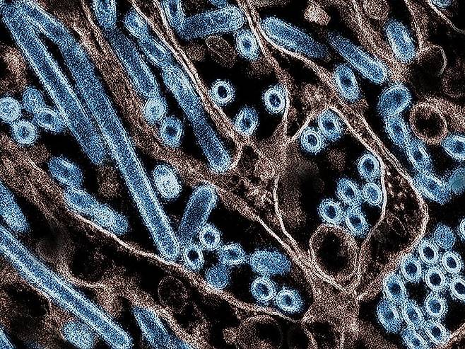 H5N1 바이러스 입자의 현미경 사진. /AFP 연합뉴스