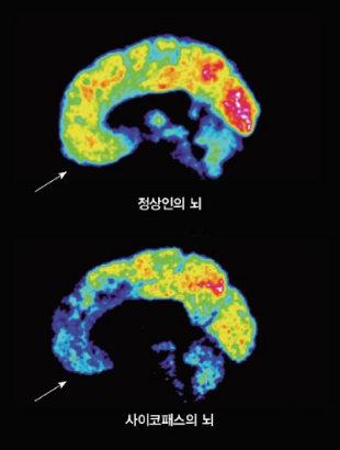 출처: http://psytimes.co.kr/m/view.php?idx=7681