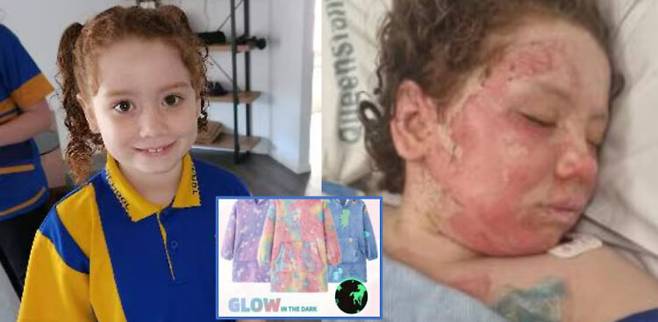 테무에서 산 잠옷에 불이 붙어 얼굴과 상체에 화상을 입은 호주의 한 소녀의 사연이 전해졌다. [사진='ABC뉴스' 보도내용 캡처]