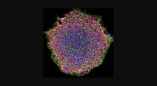 만능 줄기세포 치료술의 임상시험이 세계 각지에서 활발하게 진행되고 있다. 위 영상은 환자의 체세포로 만든 유도 만능 줄기세포(역분화 줄기세포)들이 덩어리를 이룬 모습. 색깔은 현미경 영상에다 세포의 구성 성분을 구분하고자 일부러 입힌 것이다. 위키미디어 코먼스