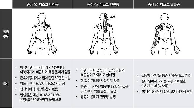 목디스크 증상. 서울대병원 제공