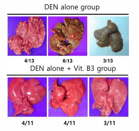 배석철 충북대 의대 교수가 15일 열린 미디어 아카데미에서 간암세포가 비타민B3 투여 후 말끔히 사라진 동물실험 결과를 공개했다. 화면 속 사진 윗줄이 초·중·말기 간암 덩어리, 아랫줄이 각각의 암세포가 사라진 간 사진이다. /사진제공=배석철 교수