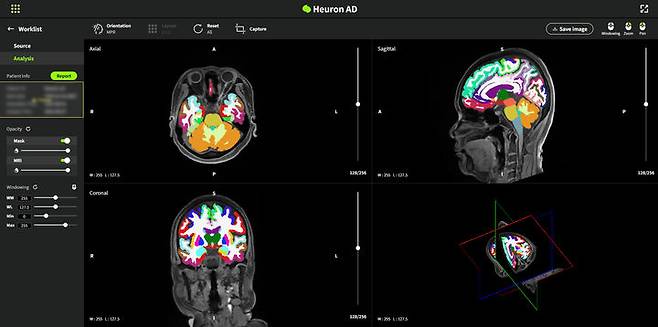 [서울=뉴시스] 26일 휴런은 대만 FDA 인허가 획득으로 올해부터 대만 전국 건강검진 센터 등에서 실제적인 매출이 발생할 예정이라고 밝혔다. (사진=휴런 제공) 2024.09.26. photo@newsis.com *재판매 및 DB 금지
