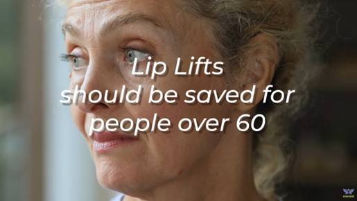Lip lift는 60대 이상에서 시행하는 것이 좋다. [사진='Doctor Youn' 유튜브 채널]