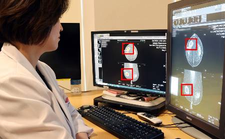 영상의학과 남상유 교수가 AI 영상진단 장비를 통해 유방암 병변(붉은 색 표시)을 확인하고 있다./사진=가천대 길병원