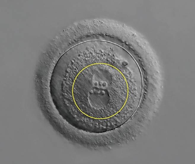 광학현미경으로 20배 확대한 인간의 수정란. 난자의 핵과 정자의 핵이 만나고 있다(노란 원). 게티이미지뱅크 제공