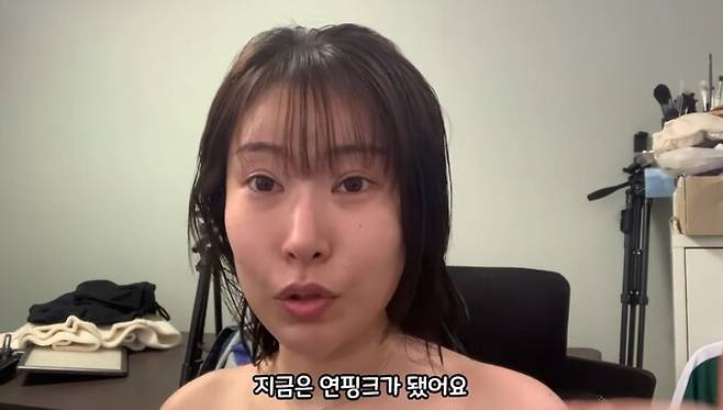 이세영이 수술 후기를 전했다. 유튜브 채널 '영평티비' 캡처.