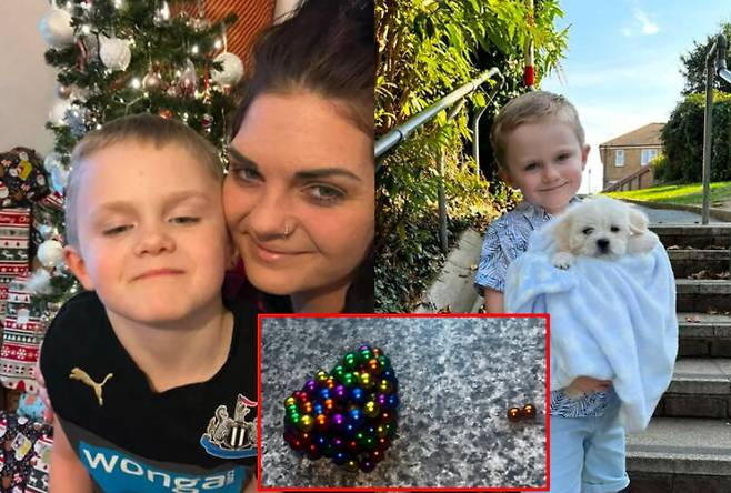 자석으로 된 구슬을 삼켜 위험에 처할 뻔한 아이의 사연이 공유됐다. [사진='뉴욕포스트' 보도내용 캡처]