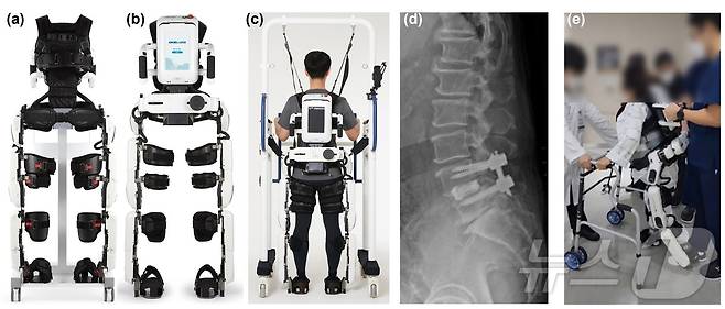 로봇 보조 보행 훈련 개념 설명 사진. (a) 보행 보조 훈련 로봇 전면 및 (b) 후면. (c) 로봇을 활용해 보행 보조 훈련 중인 환자 후면. (d) 측면 요추 방사선 사진과 (e)척추 보조기를 착용하고 보행 보조 로봇 훈련을 받는 환자 모습./연세대학교 강남세브란스 병원 제공