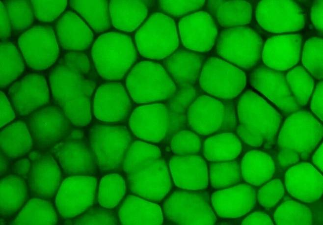 생쥐의 귀에 있는 연골세포는 지질로 가득차 있다. Raul Ramos