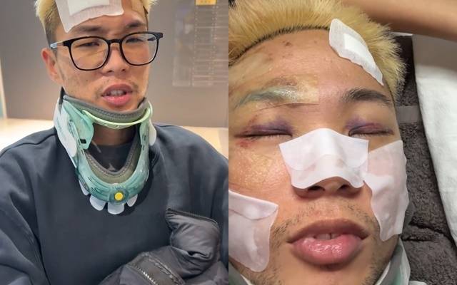 우디 고차일드 소셜미디어