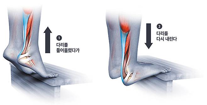 무리한 카프레이즈 운동 시 단축 경직으로 인해 아킬레스건이 짧아질 수 있음. /연세건우병원 제공