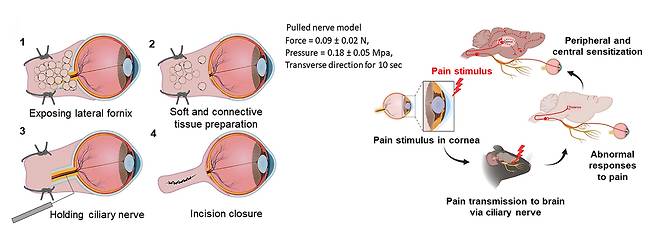 PN 모델의 외과적 절차.[GIST 제공]