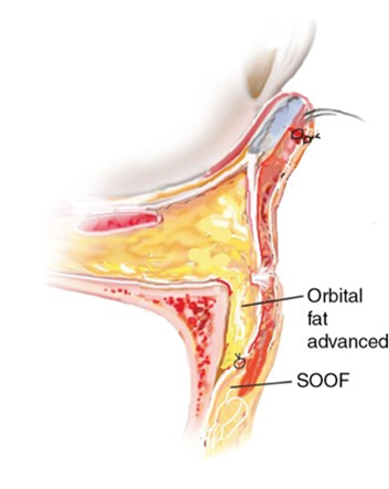 [사진=Illustration courtesy of William Winn]