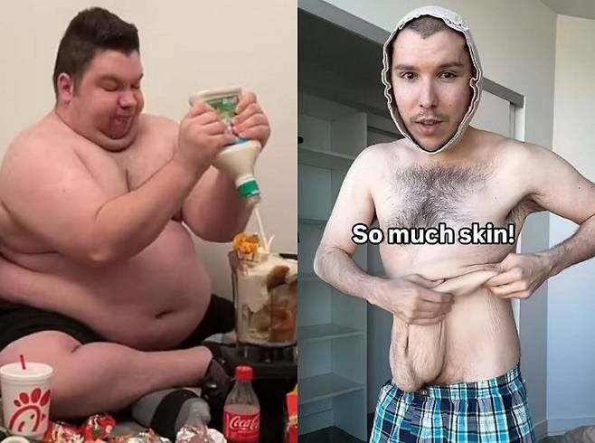 미국의 한 먹방 유튜버가 2년간 113kg을 감량한 후 겪고 있는 부작용을 밝혀 화제다. 사진은 감량 전(왼)과 감량 후(오)의 모습이다./사진=데일리메일