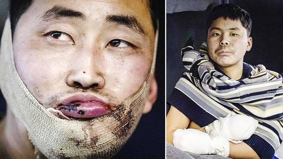 지난달 9일 우크라이나군에 의해 생포된 북한군. 볼로디미르 젤렌스키 우크라이나 대통령 엑스 캡처