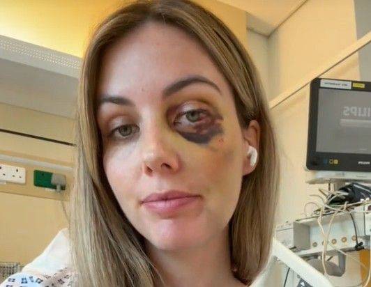 캐나다 30대 여성 에밀리가 장거리 비행 중 10시간 만에 자리에서 일어났다가 폐색전증으로 인해 의식을 잃고 바닥에 쓰러진 사연이 전해졌다. 틱톡 캡처