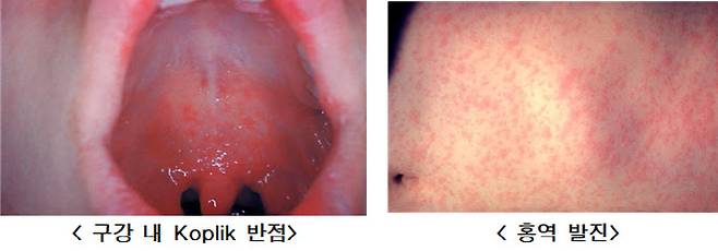 (사진=질병관리청)