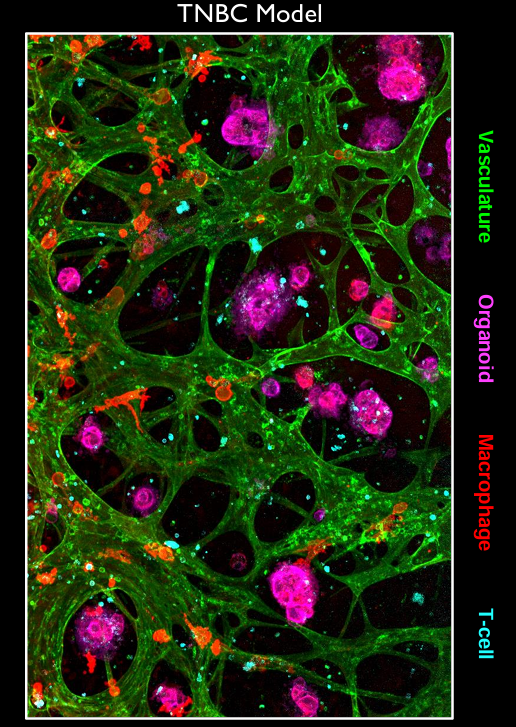 큐리에이터가 BAL0891과 키트루다를 시험한 미세생체조직시스템(MPS) 환경. 녹색이 혈관, 보라색이 오가노이드, 붉은색이 종양관련대식세포(TAM), 민트색이 T세포다. 신라젠 제공