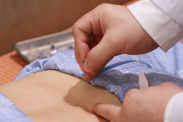 의료진이 허리디스크 침 치료를 진행하고 있는 모습. 자생한방병원