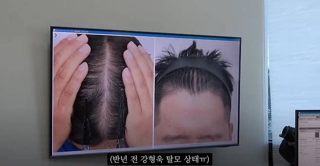 6개월전 강형욱 상태. 유튜브 채널 ‘강형욱의 보듬TV’ 영상 캡처