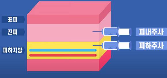 약물의 종류와 의료 목적에 따라 주사 부위가 진피냐 피하지방이냐가 갈린다. 사진은 피부 조직도. [사진=유튜브 @은근한 잡다한 지식]