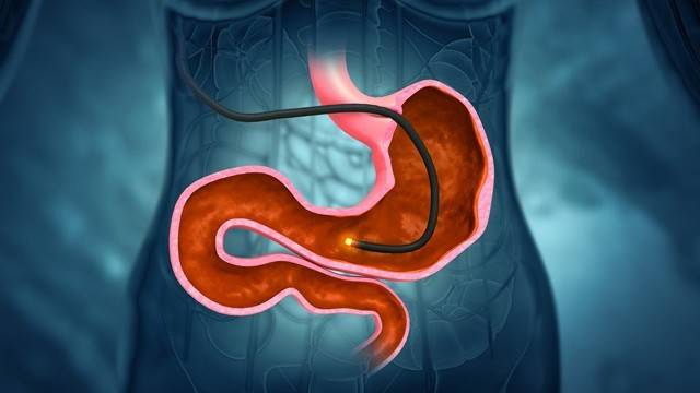 꾸준한 내시경 검사를 통해 암을 조기 진단하고 예방할 수 있다｜출처: 게티이미지뱅크