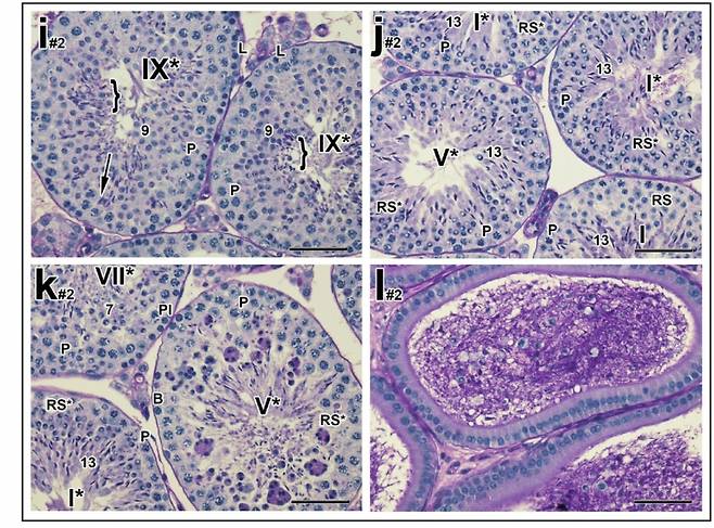 수컷 생쥐에 하루 20mg의 YCT-529를 투여한 후 정자 상태를 관찰한 모습.  /사진=네이처 커뮤니케이션