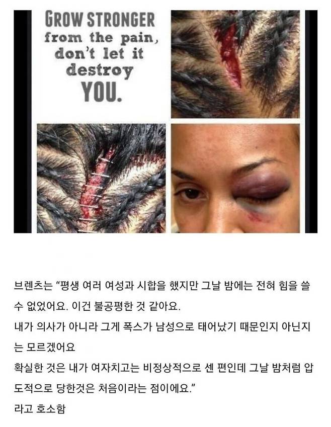 트랜드젠더 선수와 싸운 여성 선수 트랜드젠더 선수와 싸운 여성 선수 .jpg