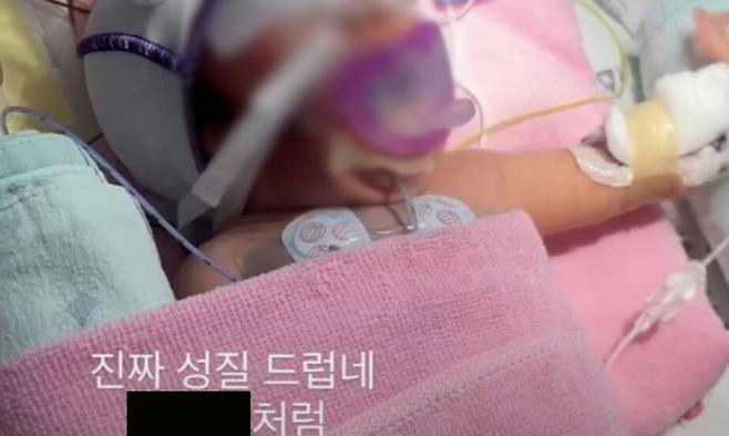 image.png ‘중환자실 신생아 학대’ 피해 부모 “아이 이름도 바꿔…일상 마비”