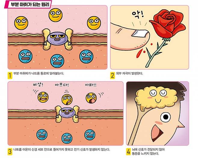 부분마취가 되는 원리. 어린이과학동아 제공