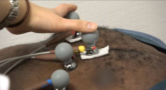 3.jpeg 조나단이 레이저 제모 못하는 이유.jpg