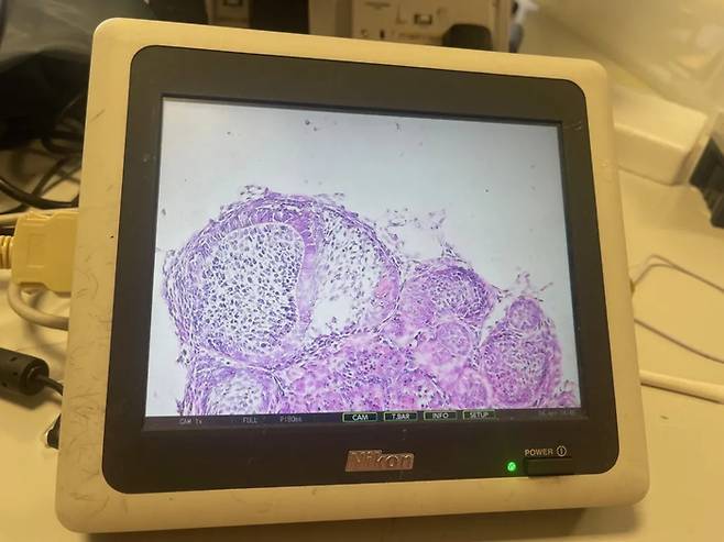 실험실 환경에서 배양한 치아를 현미경으로 확대한 모습. 사진=킹스 칼리지 런던 연구팀